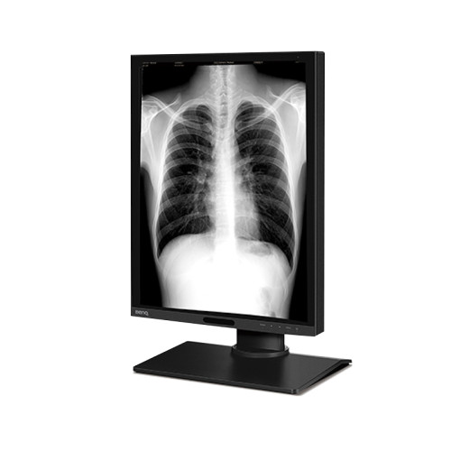 مانیتور بنکیو BenQ MD310G مانیتور بنکیو BenQ MD310G