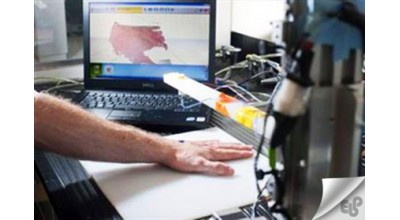 کمک پرینترهای سه بعدی برای درمان سوختگی